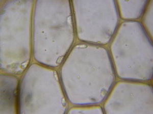 Picture of Calypogeia fissa oil bodies
